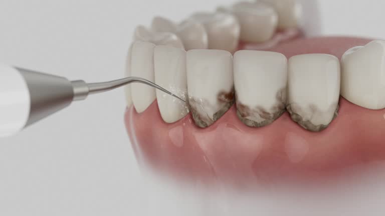 Trusted Root Canal Treatment service in Rossville, IN - Dentist Open Now
